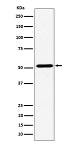 NPY5R Recombinant Rabbit Monoclonal Antibody (K01_4P45)