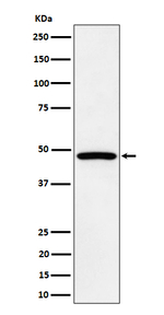 PTP1B/PTPN2 Recombinant Rabbit Monoclonal Antibody (K01_4P47)