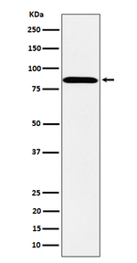 PPM1E Recombinant Rabbit Monoclonal Antibody (K01_4P48)
