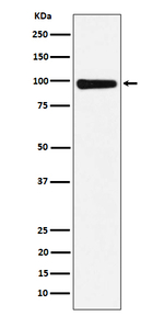 CHM Recombinant Rabbit Monoclonal Antibody (K01_4P50)