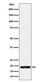 TXNDC12 Recombinant Rabbit Monoclonal Antibody (K01_4P53)