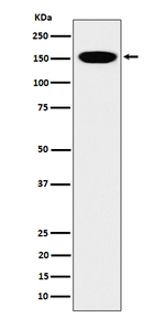 NCAPD2 Recombinant Rabbit Monoclonal Antibody (K01_4P56)