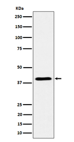 ADH4 Recombinant Rabbit Monoclonal Antibody (K01_4P58)