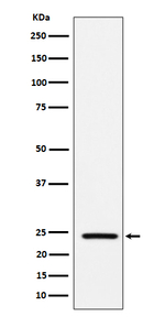 Acetyl-SOD2 (Lys68) Recombinant Rabbit Monoclonal Antibody (K01_4P60)