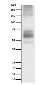 SSTR1 Recombinant Rabbit Monoclonal Antibody (K01_4P61)