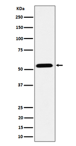 ENPP5 Recombinant Rabbit Monoclonal Antibody (K01_4P65)