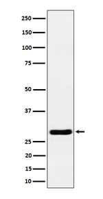 RCAN1 Recombinant Rabbit Monoclonal Antibody (K01_4P69)