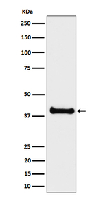 ALS2CR1 Recombinant Rabbit Monoclonal Antibody (K01_4P74)