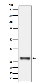 PNMT Recombinant Rabbit Monoclonal Antibody (K01_4P76)