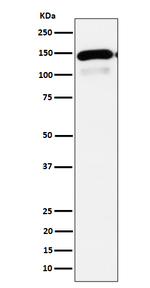 PLCB1 Recombinant Rabbit Monoclonal Antibody (K01_4P78)