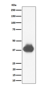 CD32a/CD32b/CD32c Recombinant Rabbit Monoclonal Antibody (K01_4P79)
