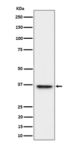 ULBP1 Recombinant Rabbit Monoclonal Antibody (K01_4P83)