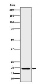 BCL2L15 Recombinant Rabbit Monoclonal Antibody (K01_4P89)