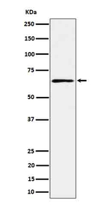RIP2 Recombinant Rabbit Monoclonal Antibody (K01_4P90)