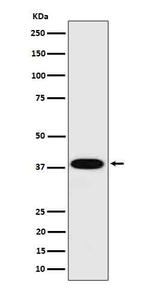 Cathepsin H Recombinant Rabbit Monoclonal Antibody (K01_4P92)