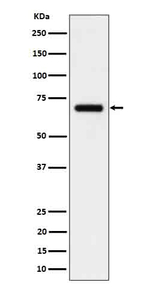 IL5RA Recombinant Rabbit Monoclonal Antibody (K01_4P99)