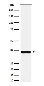 GGH Recombinant Rabbit Monoclonal Antibody (K01_4Q01)