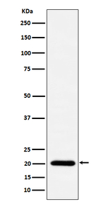 TIMM22 Recombinant Rabbit Monoclonal Antibody (K01_4Q13)