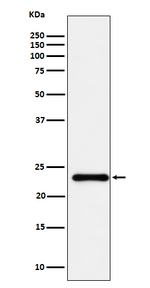 UBE2T Antibody in Western Blot (WB)