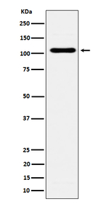 EXOC2 Recombinant Rabbit Monoclonal Antibody (K01_4Q16)