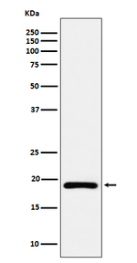 DUT Recombinant Rabbit Monoclonal Antibody (K01_4Q17)