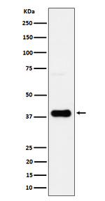 CXCR6 Recombinant Rabbit Monoclonal Antibody (K01_4Q18)