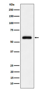 GTF2E1 Recombinant Rabbit Monoclonal Antibody (K01_4Q19)