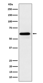 Cdc73 Recombinant Rabbit Monoclonal Antibody (K01_4Q20)