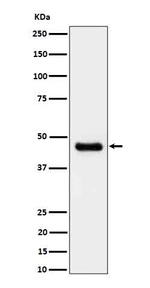 CABP1 Recombinant Rabbit Monoclonal Antibody (K01_4Q26)