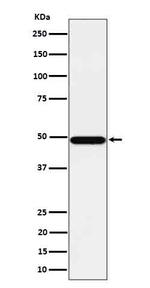 PSMC4 Recombinant Rabbit Monoclonal Antibody (K01_4Q29)
