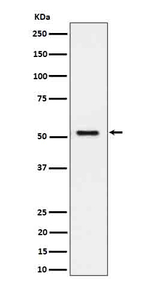 SEC62 Recombinant Rabbit Monoclonal Antibody (K01_4Q30)