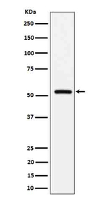 Fetuin B Recombinant Rabbit Monoclonal Antibody (K01_4Q33)