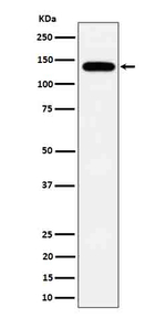 TPP2 Recombinant Rabbit Monoclonal Antibody (K01_4Q36)