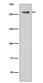 Phospho-LRRK2 (Ser935) Recombinant Rabbit Monoclonal Antibody (K01_4Q40)