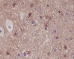 Phospho-PAK1/2/3 (Ser144, Ser141, Ser139) Recombinant Rabbit Monoclonal Antibody (K01_4Q43)
