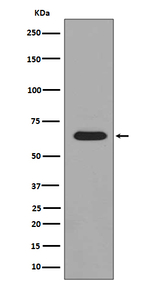 Phospho-PAK1/2/3 (Ser144, Ser141, Ser139) Antibody in Western Blot (WB)