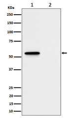 Phospho-MLKL (Ser345) Recombinant Rabbit Monoclonal Antibody (K01_4Q62)