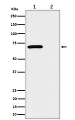 Phospho-Chk2 (Thr68) Recombinant Rabbit Monoclonal Antibody (K01_4Q63)