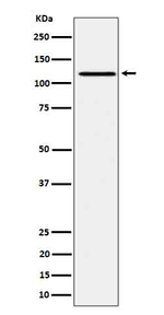 Phospho-JAK1 (Tyr1034, Tyr1035) Recombinant Rabbit Monoclonal Antibody (K01_4Q70)