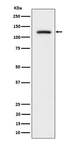 Phospho-ULK1 (Ser556) Recombinant Rabbit Monoclonal Antibody (K01_4Q76)