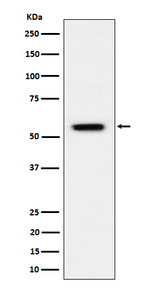 Phospho-Vimentin (Ser39) Recombinant Rabbit Monoclonal Antibody (K01_4Q77)