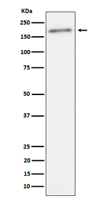Phospho-ErbB2 (HER-2) (Tyr1221, Tyr1222) Antibody in Western Blot (WB)