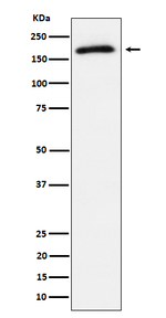 Phospho-AS160 (Thr642) Recombinant Rabbit Monoclonal Antibody (K01_4Q83)