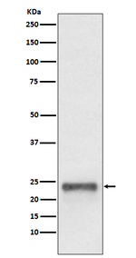 UBD Antibody in Western Blot (WB)