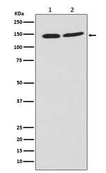 PHF8 Antibody in Western Blot (WB)
