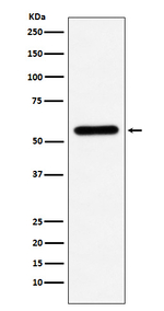 CES1 Antibody in Western Blot (WB)