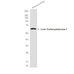 CES1 Recombinant Rabbit Monoclonal Antibody (K01_4R04)