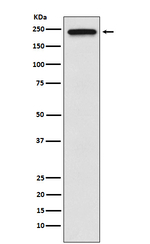 TRPM7 Antibody in Western Blot (WB)