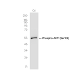 Phospho-AKT1 (Ser124) Antibody in Western Blot (WB)