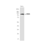 ERK5 Antibody in Western Blot (WB)